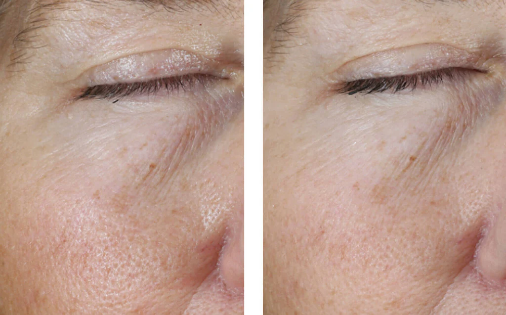 EyeGel_Results4HQP1600x995_v1_1024x1024